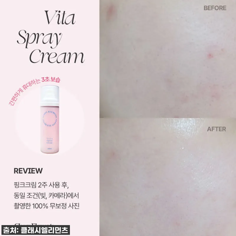 피부 속건조 이젠 안녕! 화잘먹 멜라 참고 자료